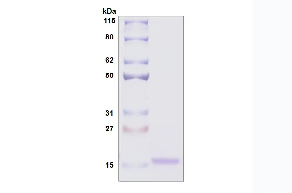 Recombinant Human Galectin 10, His Tag -50 ug
